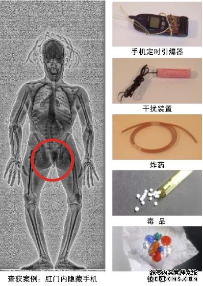 conpass进口人体扫描仪,人体x光透视仪,人体安全检查系统